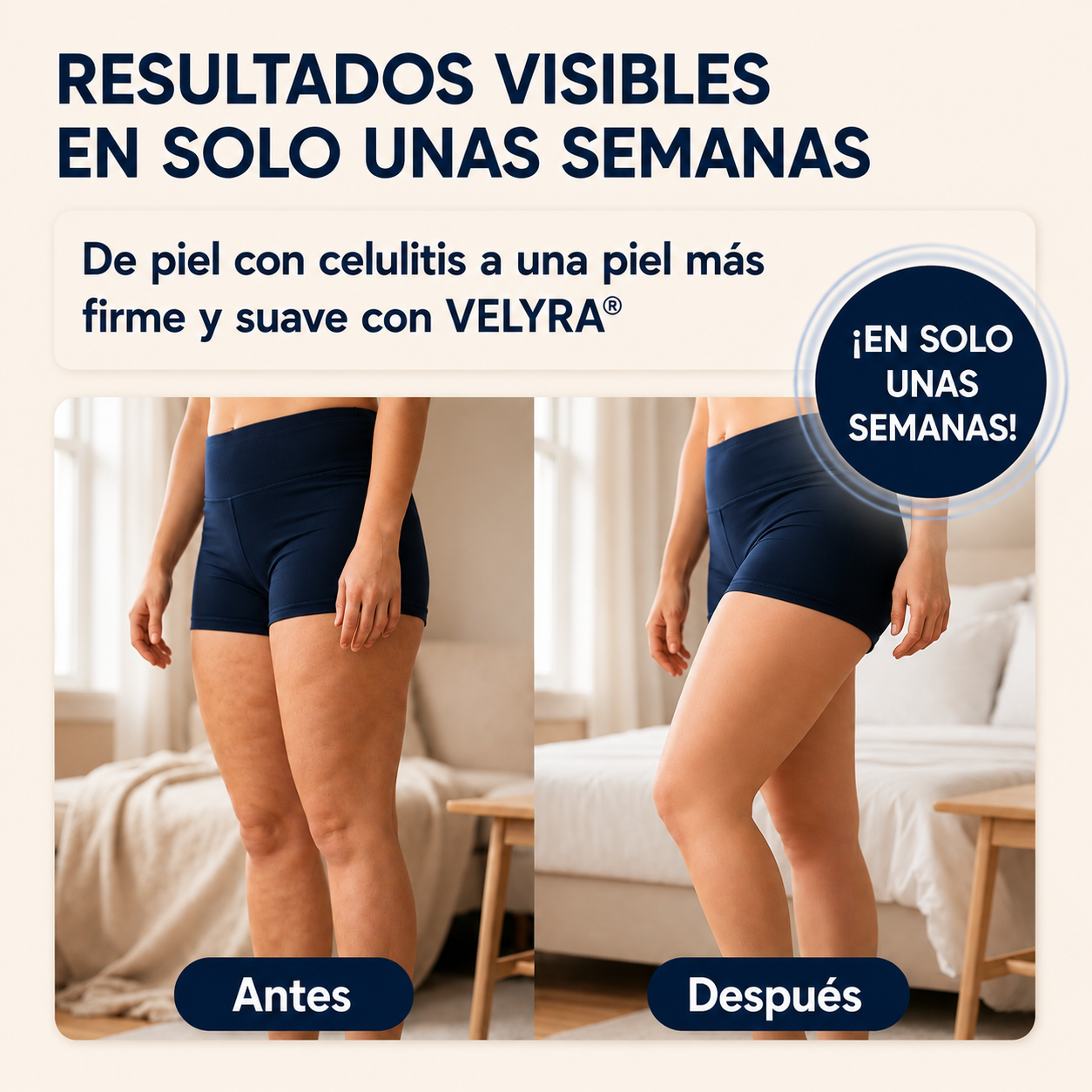 Piernas ligeras, piel firme y sin celulitis