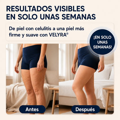 Piernas ligeras, piel firme y sin celulitis